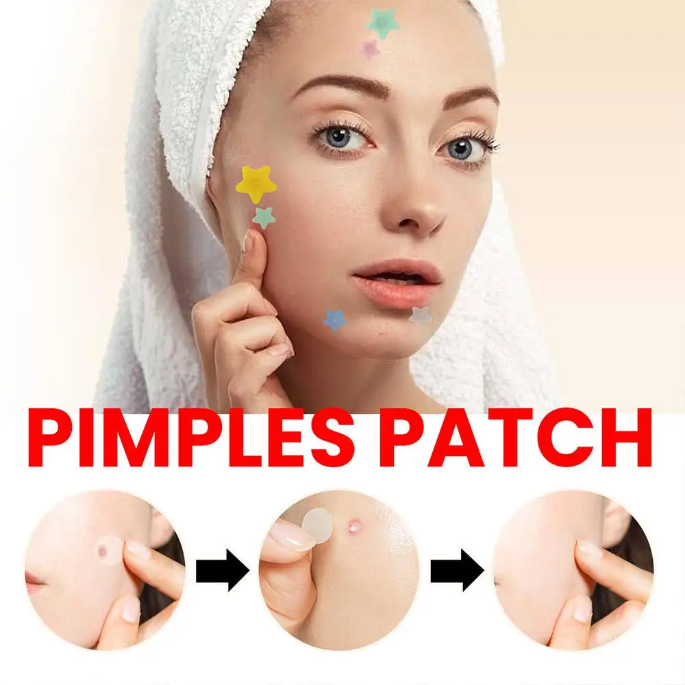 200pcs Colorful Star & Heart Acne Pimple Patches