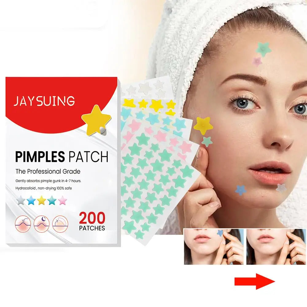 200pcs Colorful Star & Heart Acne Pimple Patches